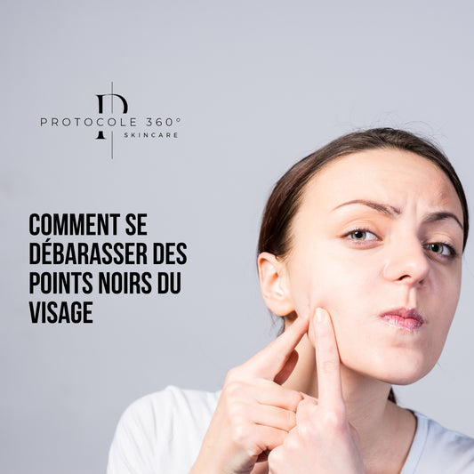 Comment faire pour enlever les points noirs ?